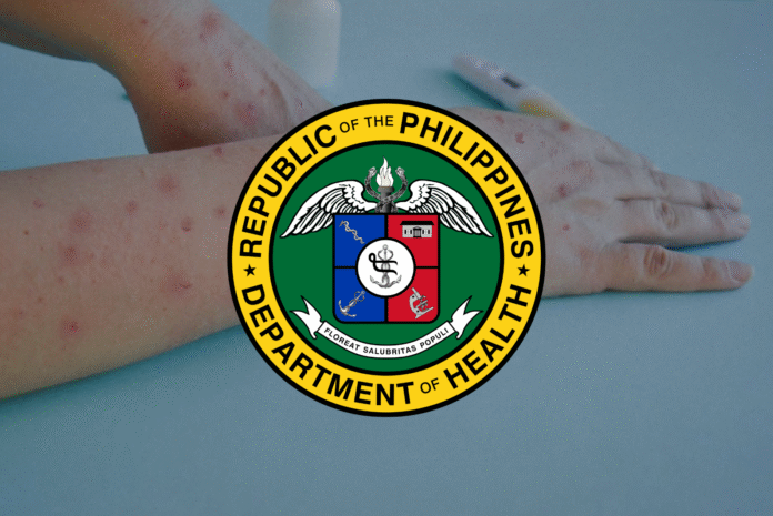 MPOX-DOH